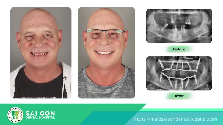 vietnam dental tour 3 vietnam dental tour 3